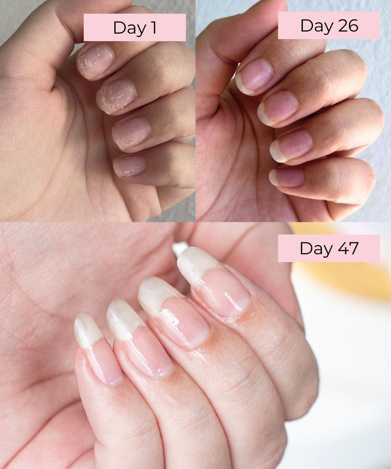 How to grow longer natural nails without the need for expensive treatm Body Collective Co