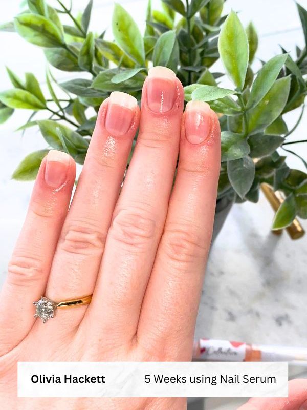 Nail Serum Pen Pack | 8 Twist Pens (50% OFF)