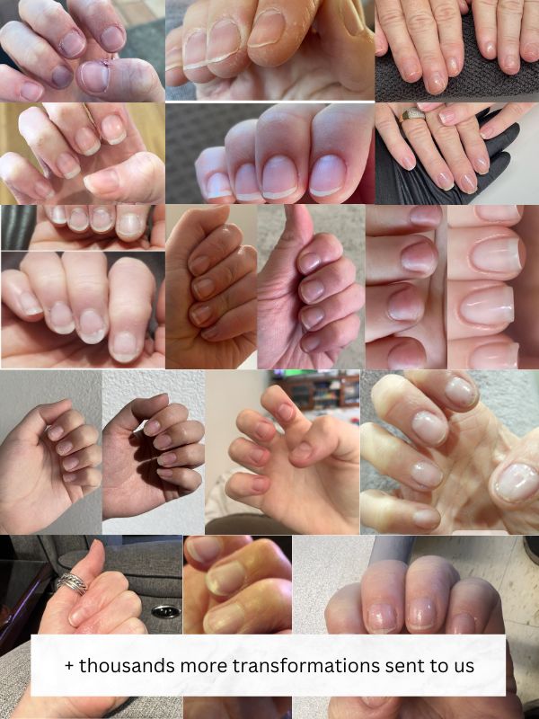 Nail Serum Pen Pack | 8 Twist Pens (50% OFF)