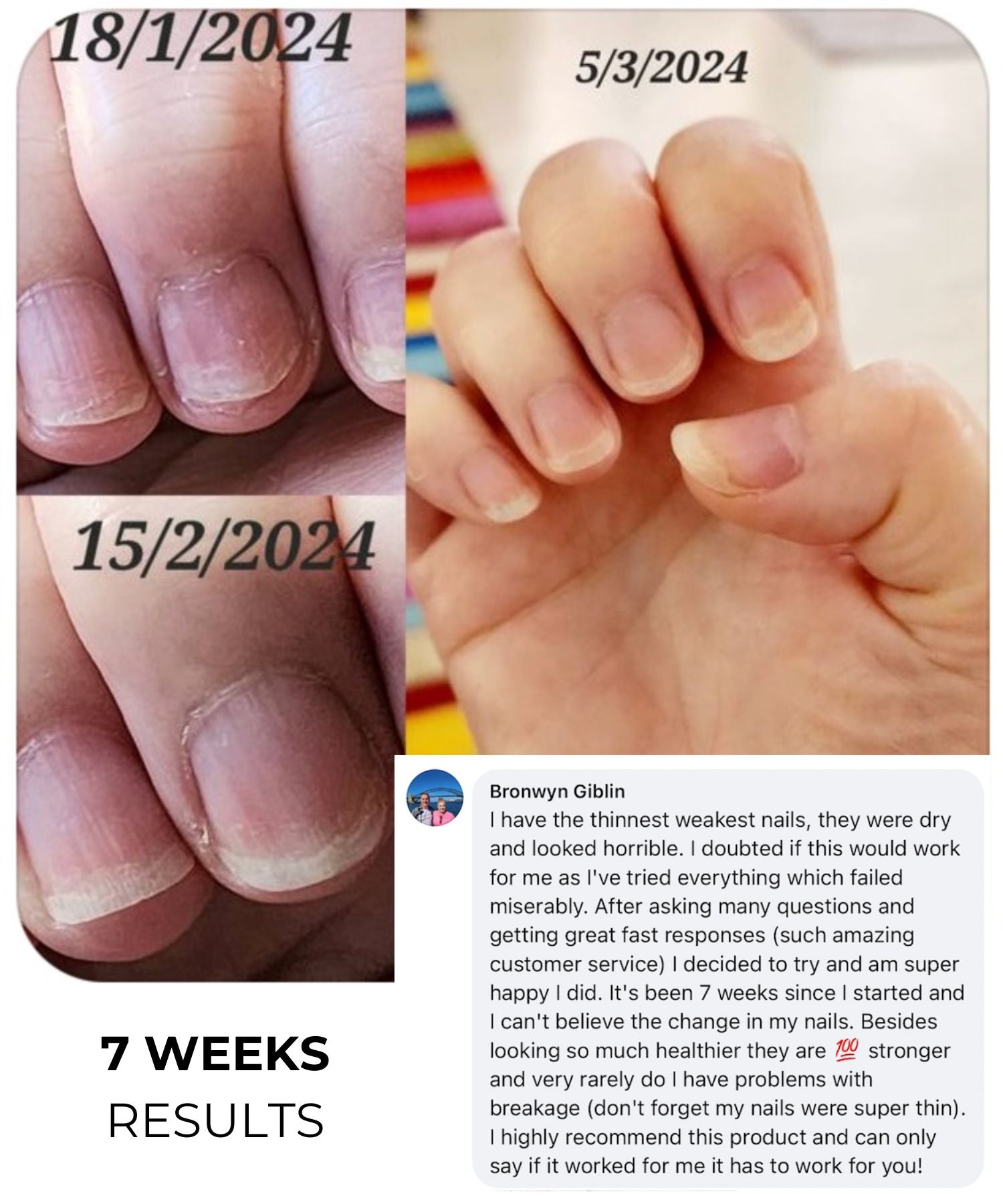 Nail Serum Pen Pack | 8 Twist Pens (50% OFF)