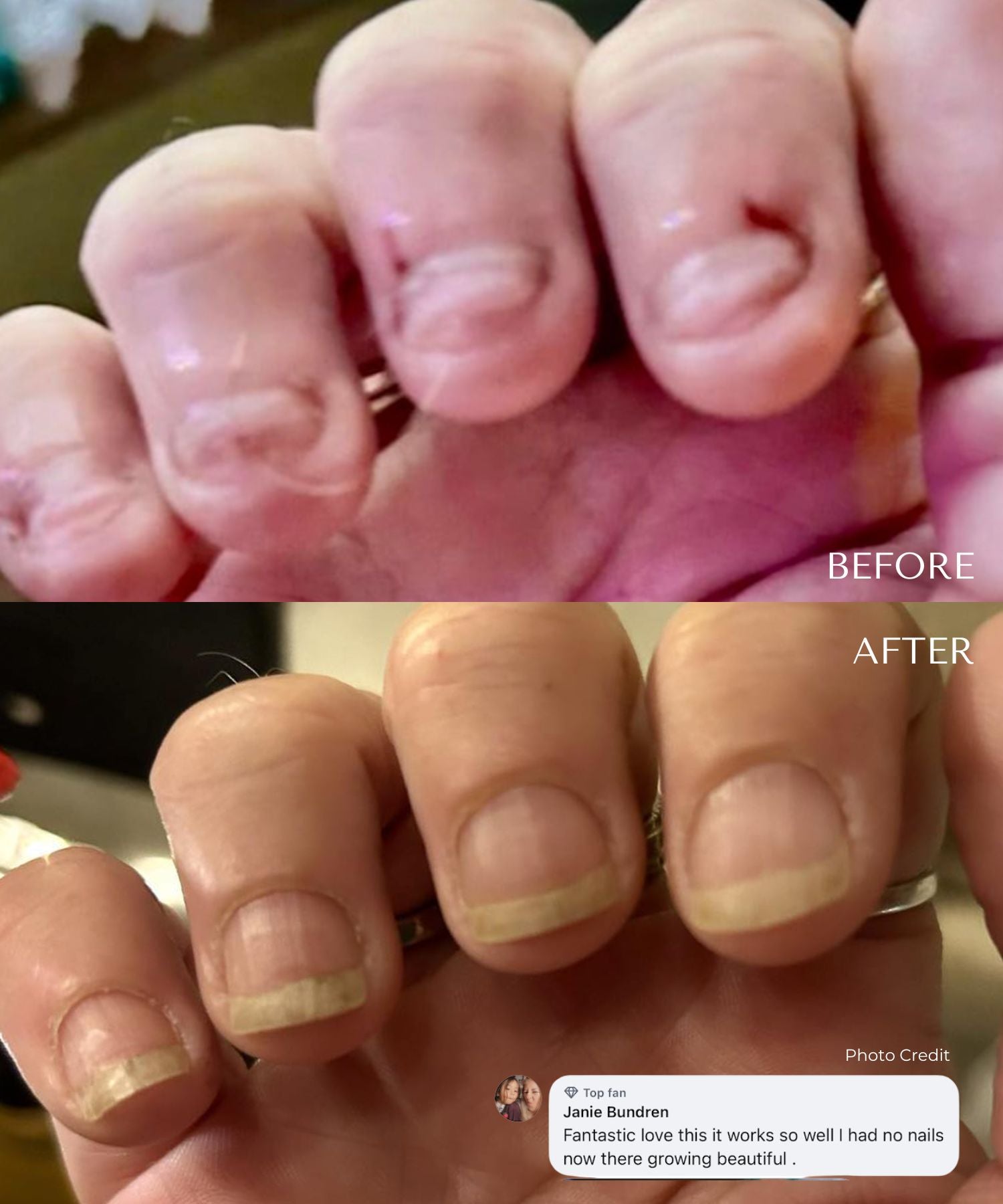 Nail Growth & Strength Serum | 15ml Dropper