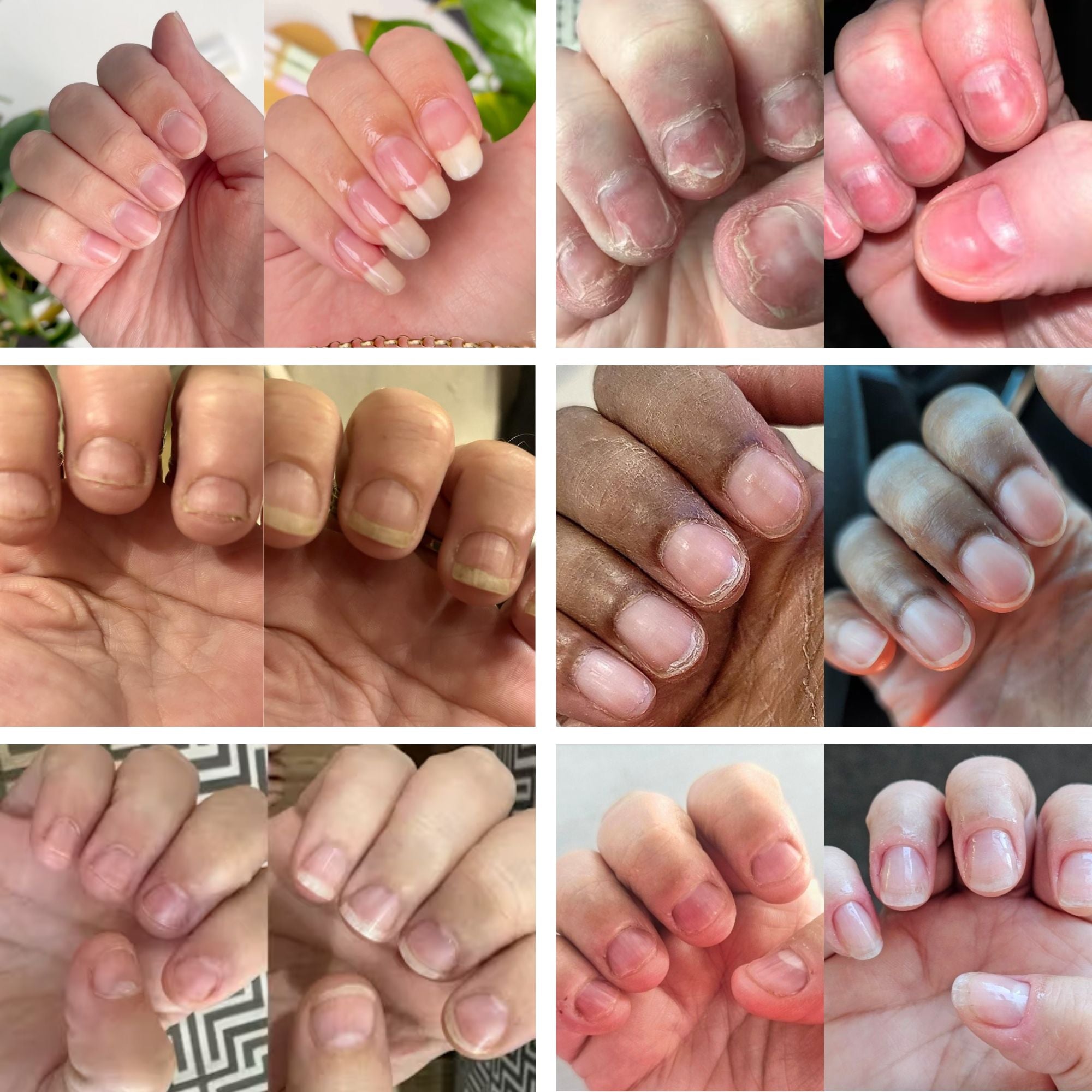 Nail Serum Pen Pack | 8 Twist Pen Bundle CLEARANCE