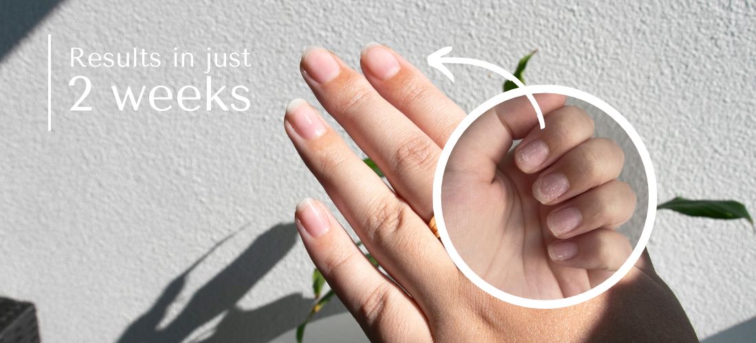 An at-home nail treatment for less than $15!